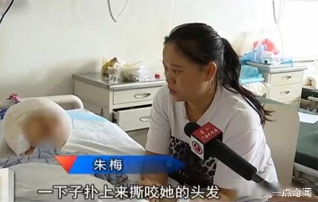 女孩被自家狗撕咬 宠物狗发狂连自家人都咬