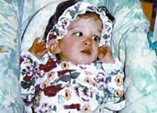 不老女婴之谜 20岁的布鲁克·格林伯格外表像1岁